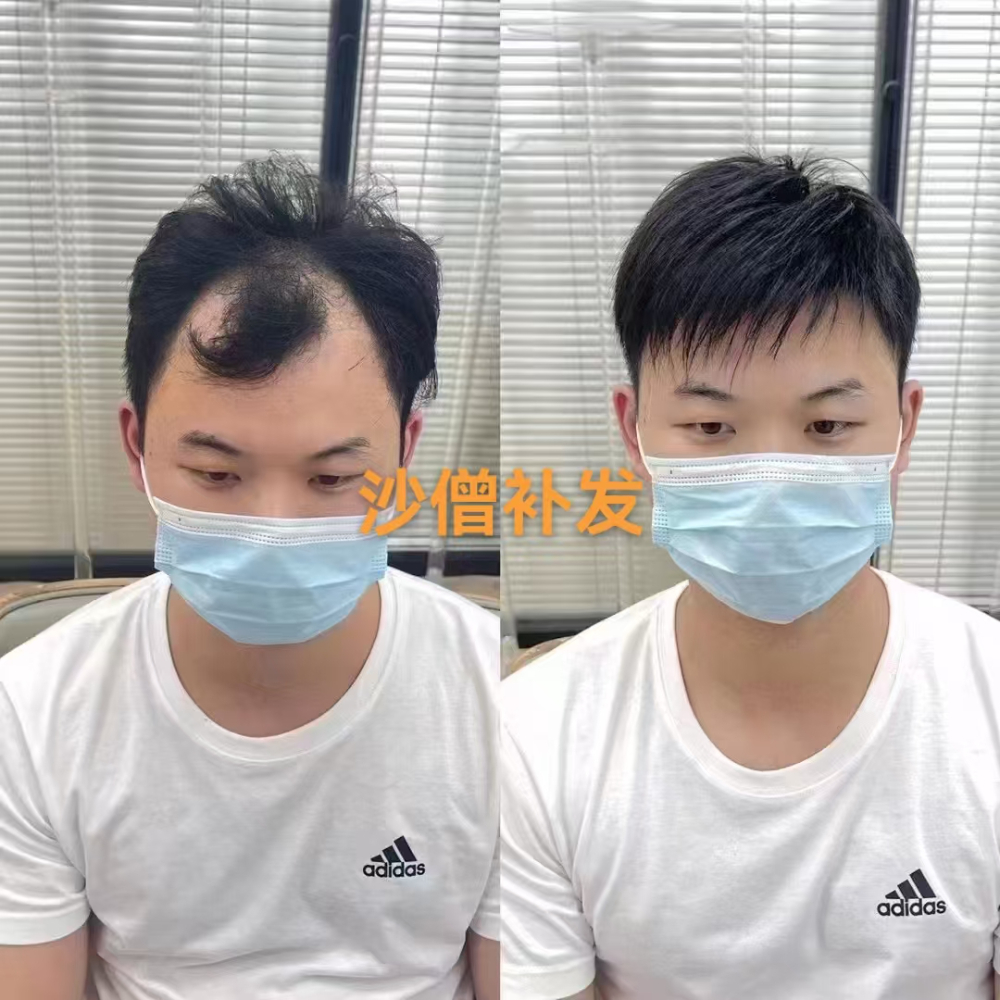 案例-沙僧假发 (8).jpg